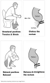 rectum.webp rectum.webp