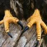 SeveredTendon